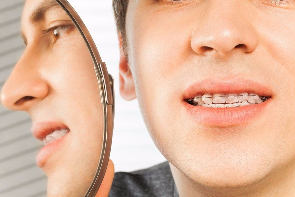 braces, dental care